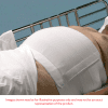 Dale Abdominal Binder 4-Panel - Image 3