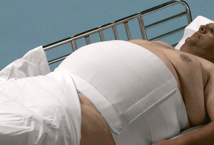 Dale Abdominal Binders - Image 3