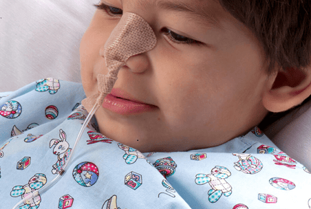 Dale NasoGastric Tube Holders - Image 2