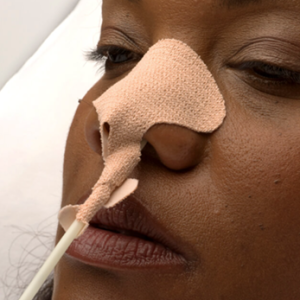 Dale NasoGastric Tube Holders