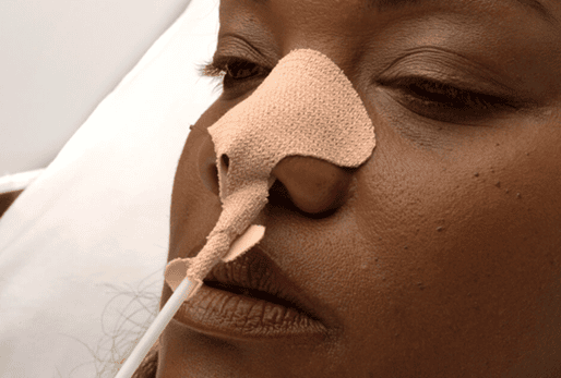 Dale NasoGastric Tube Holders
