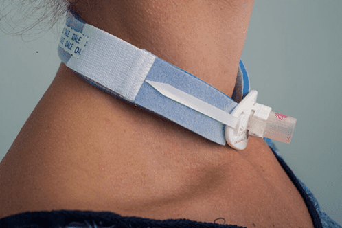 Dale Tracheostomy Tube Holders