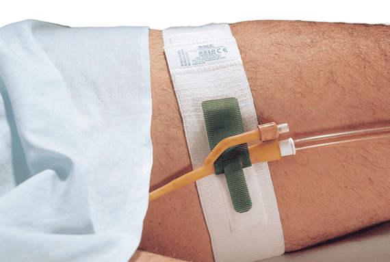Dale Hold-n-Place Foley Catheter Holders - Image 2