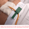 Dale Hold-n-Place Bariatric Foley Catheter Holder 10/Box - Image 2