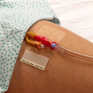 Dale Hold-n-Place Foley Catheter Holders