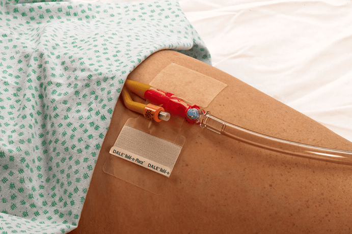 Dale Hold-n-Place Foley Catheter Holders
