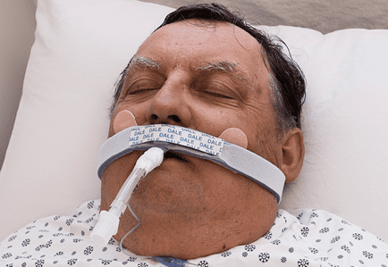 Dale Endotracheal Tube Holders